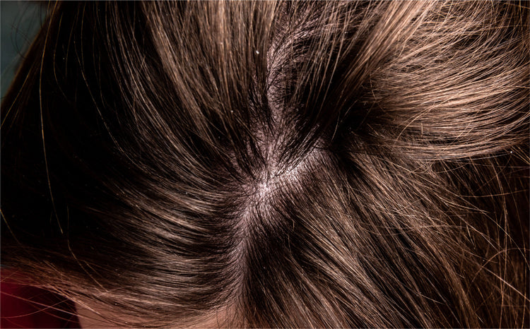 Dandruff Control