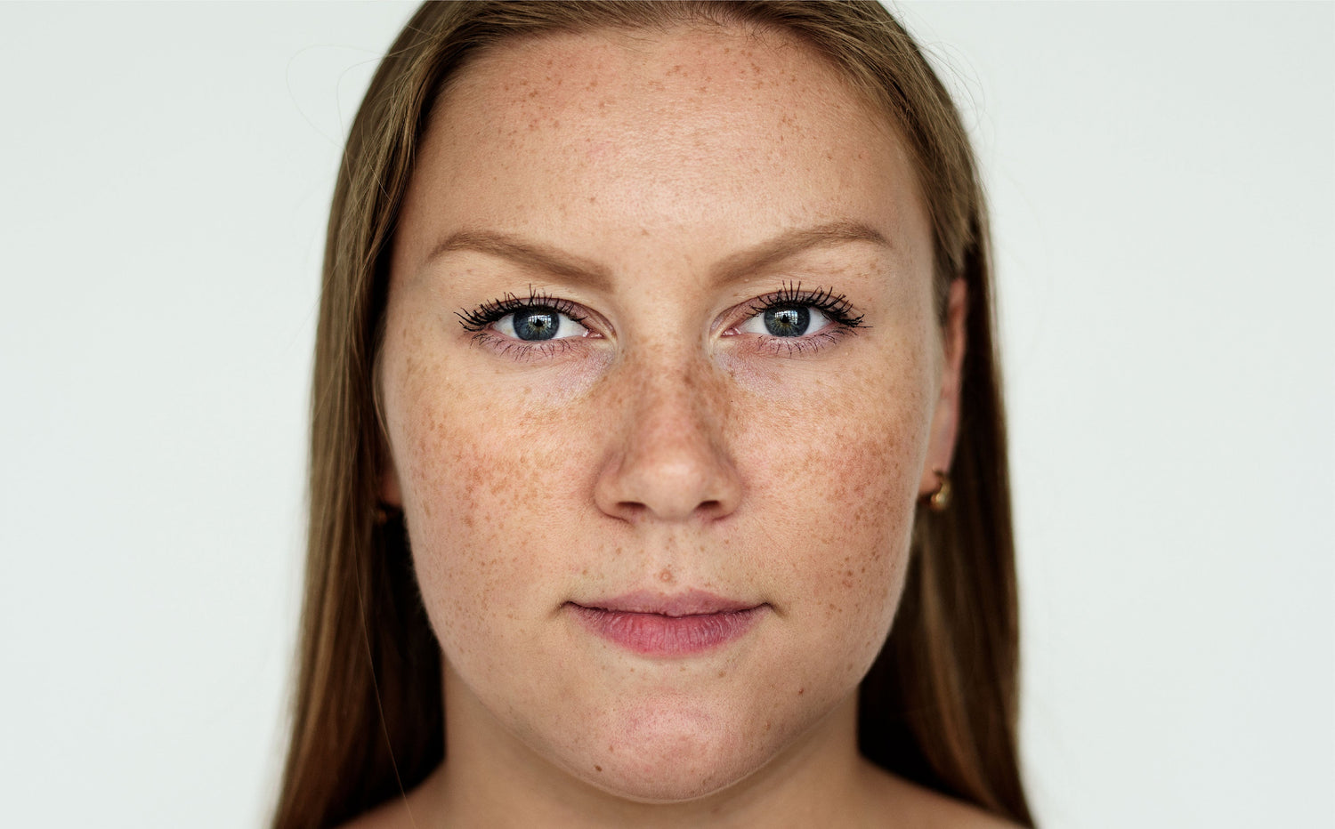 Dark Spots and Pigmentation
